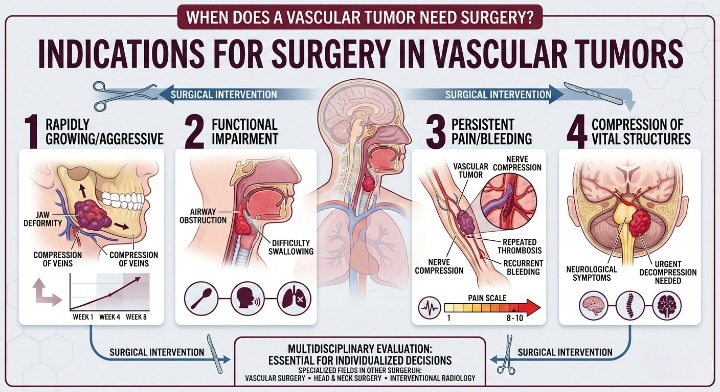 Key Situations Where Surgery Is Required