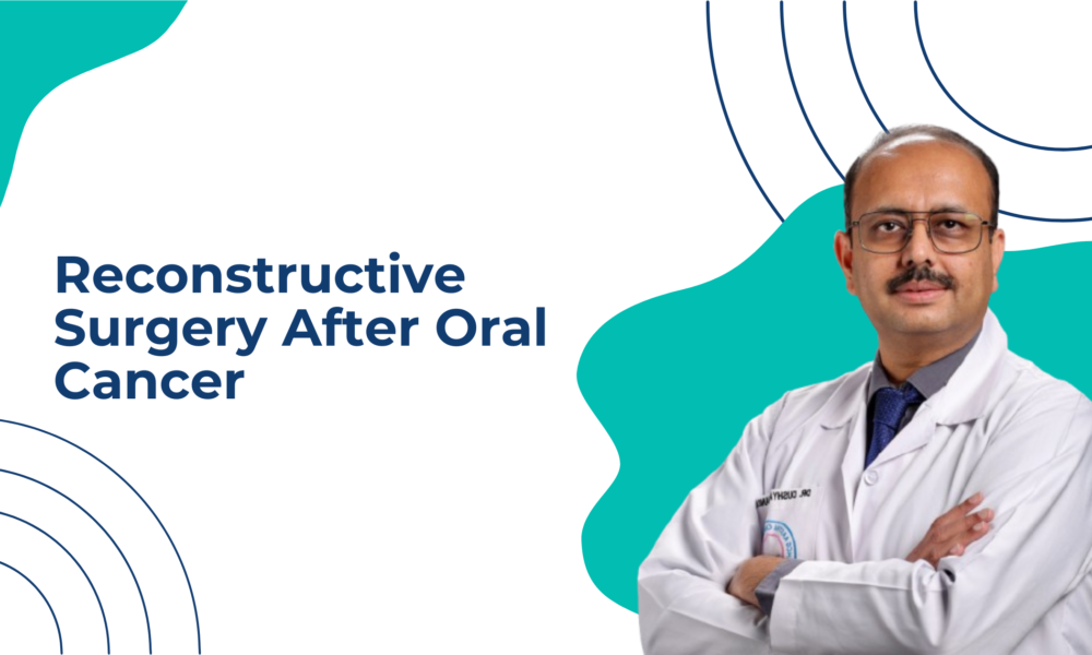Reconstructive Surgery After Oral Cancer