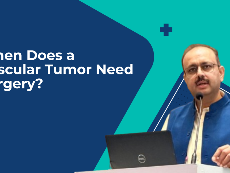 When Does a Vascular Tumor Need Surgery?