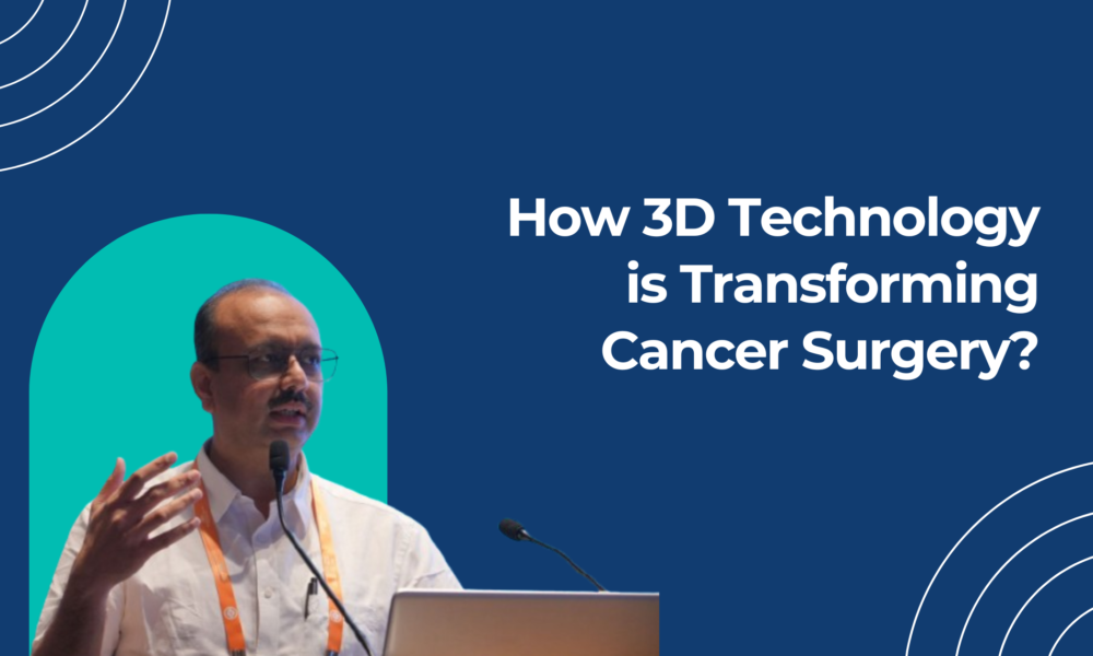 How 3D Technology is Transforming Cancer Surgery