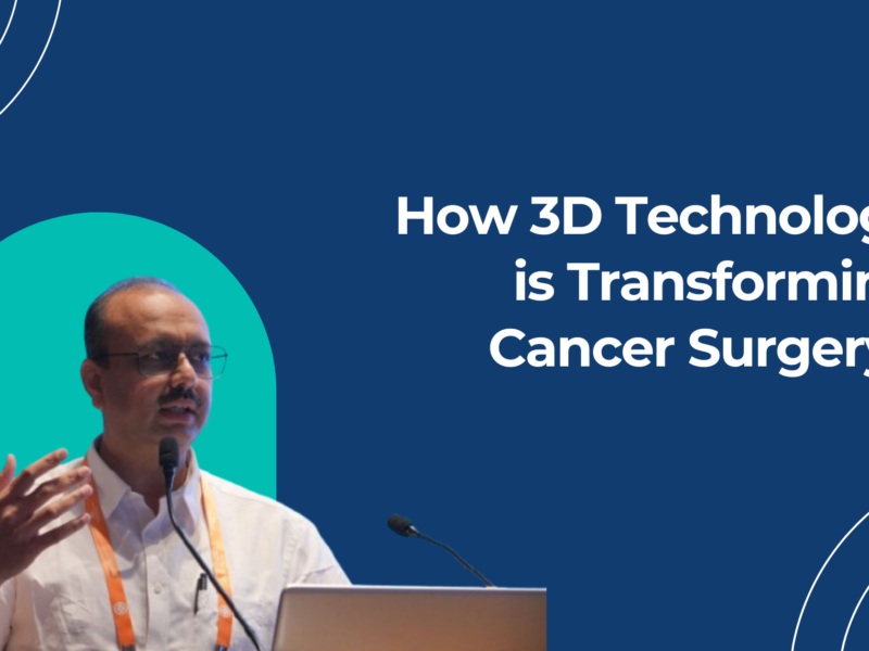 How 3D Technology is Transforming Cancer Surgery