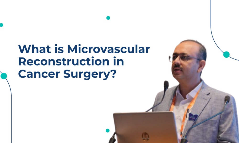 What is Microvascular Reconstruction in Cancer Surgery