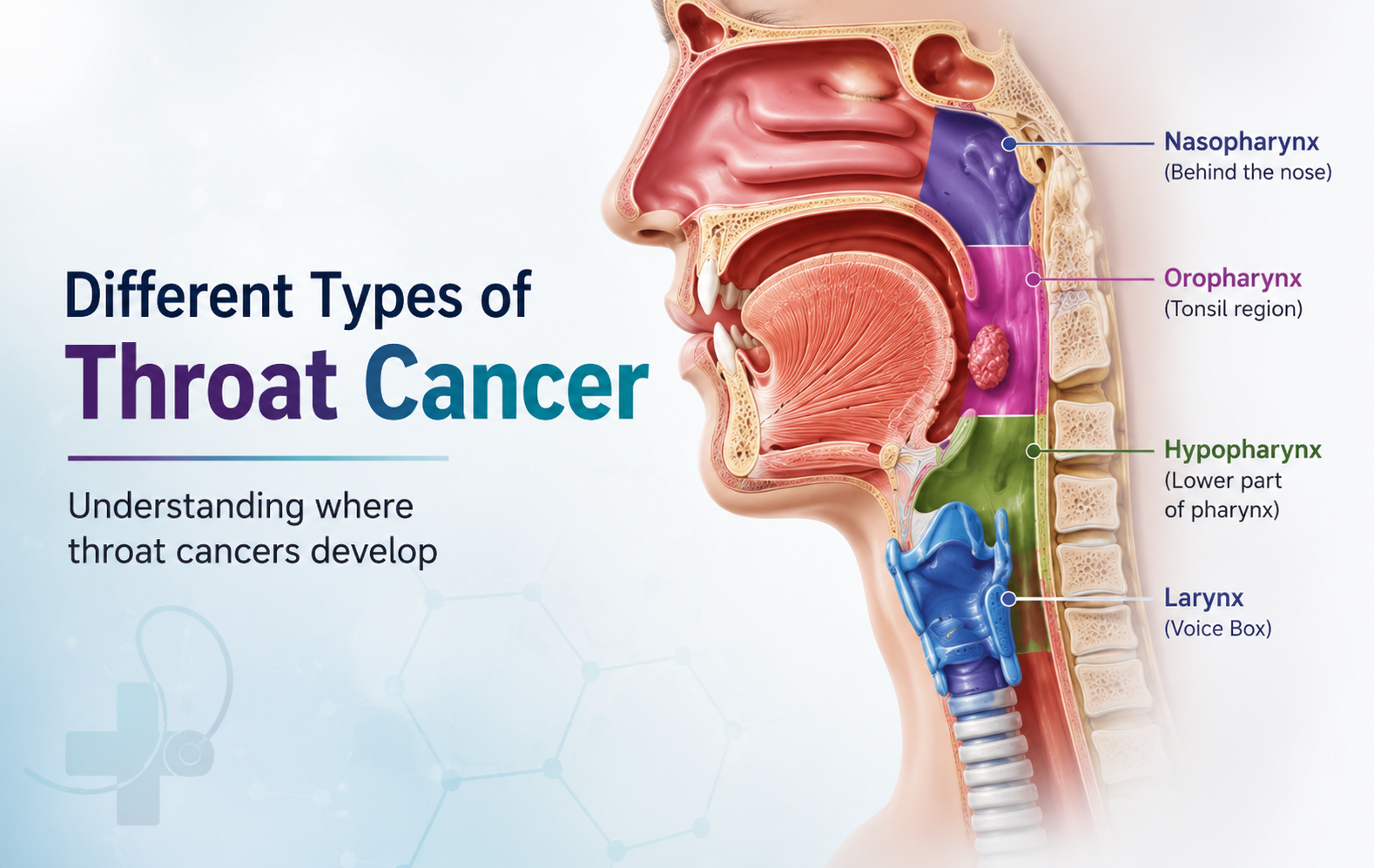 Types of Throat Cancer: A Complete Guide